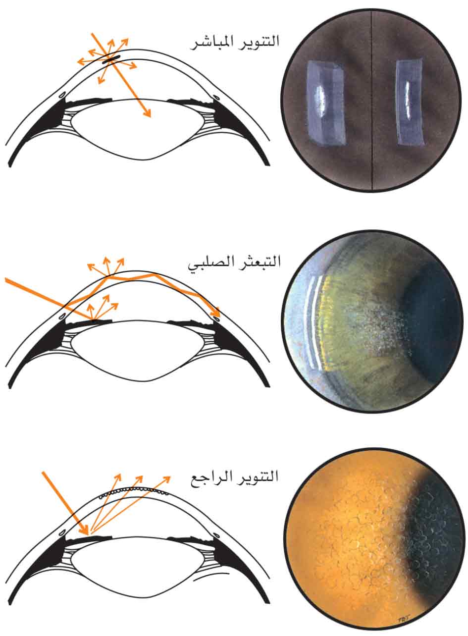 الموسوعة العربية | تقنيات فحص العين
