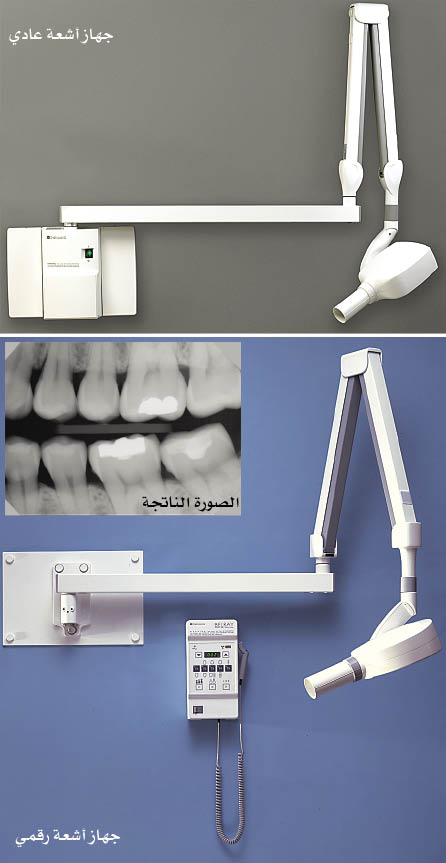 الموسوعة العربية | الأسنان (تجهيزات وأدوات تشخيص-)